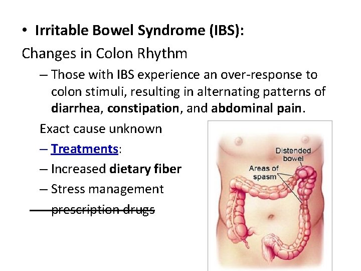  • Irritable Bowel Syndrome (IBS): Changes in Colon Rhythm – Those with IBS