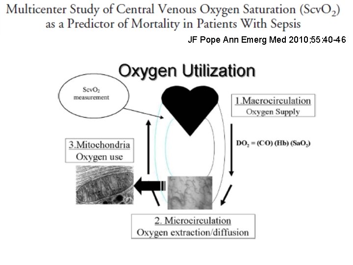 JF Pope Ann Emerg Med 2010; 55: 40 -46 