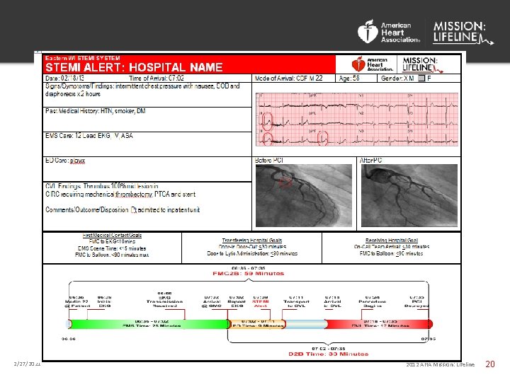 2/27/2021 2012 AHA Mission: Lifeline 20 