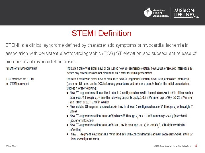 STEMI Definition STEMI is a clinical syndrome defined by characteristic symptoms of myocardial ischemia