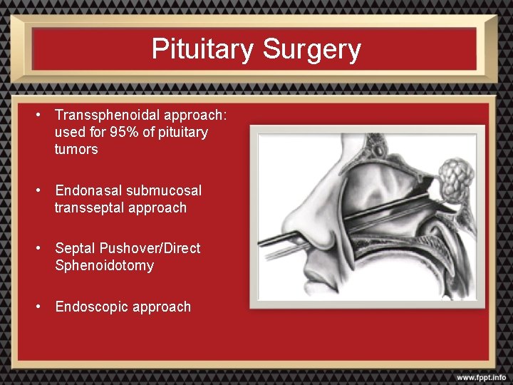 Pituitary Surgery • Transsphenoidal approach: used for 95% of pituitary tumors • Endonasal submucosal