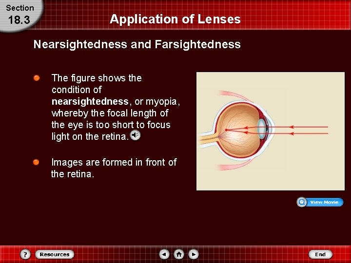 Section 18. 3 Application of Lenses Nearsightedness and Farsightedness The figure shows the condition