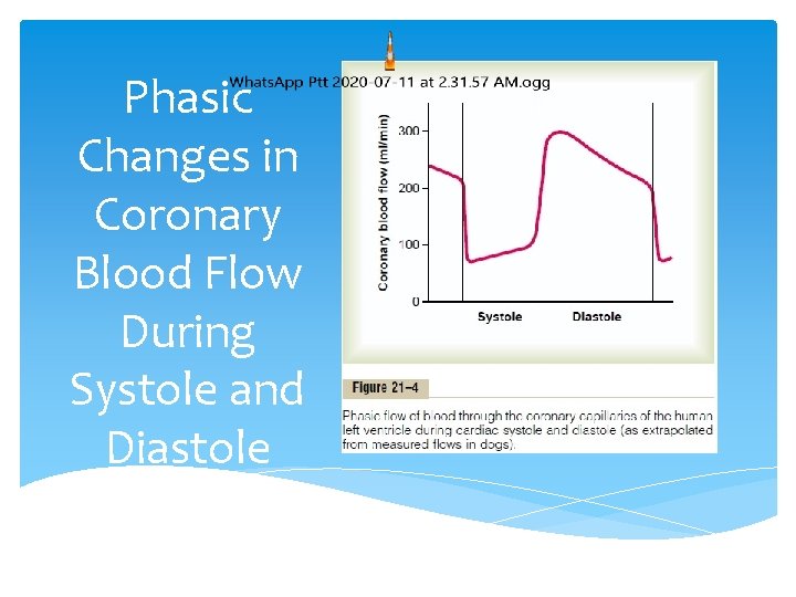 Phasic Changes in Coronary Blood Flow During Systole and Diastole 