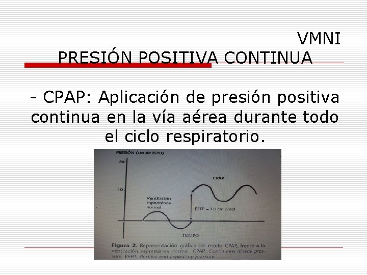 VMNI PRESIÓN POSITIVA CONTINUA - CPAP: Aplicación de presión positiva continua en la vía