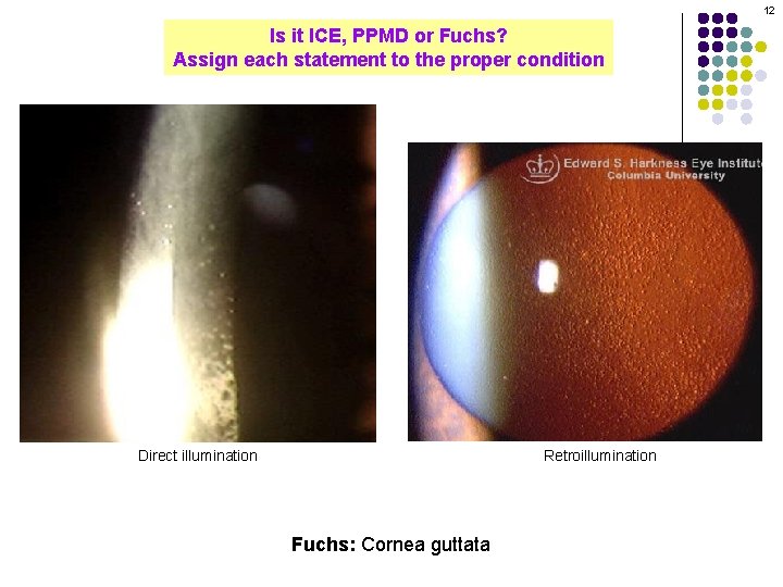 12 Is it ICE, PPMD or Fuchs? Assign each statement to the proper condition