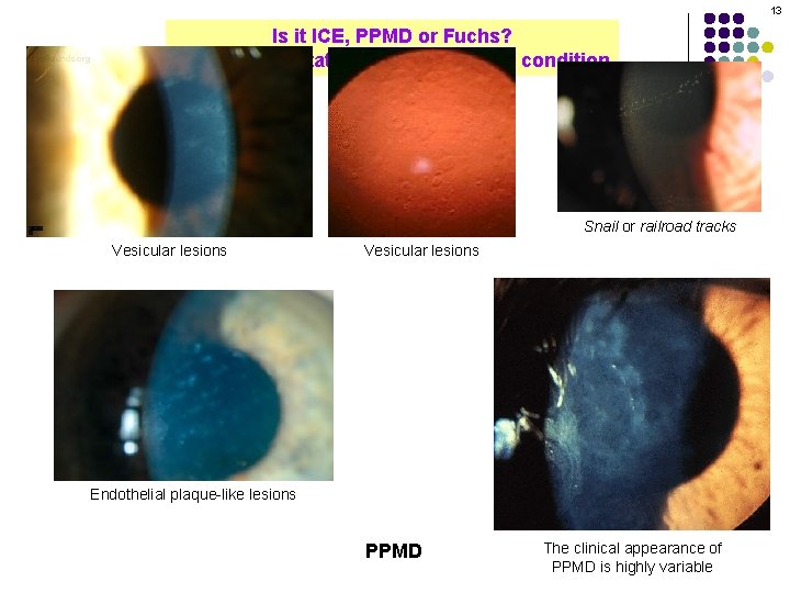 13 Is it ICE, PPMD or Fuchs? Assign each statement to the proper condition