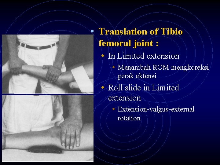  • Translation of Tibio femoral joint : • In Limited extension • Menambah