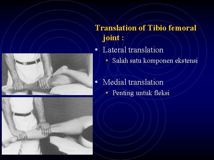 Translation of Tibio femoral joint : • Lateral translation • Salah satu komponen ekstensi
