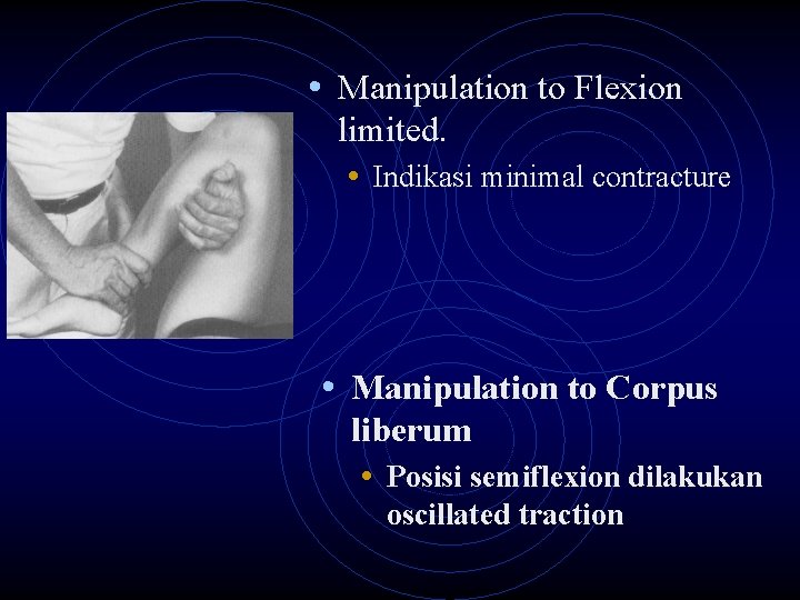  • Manipulation to Flexion limited. • Indikasi minimal contracture • Manipulation to Corpus