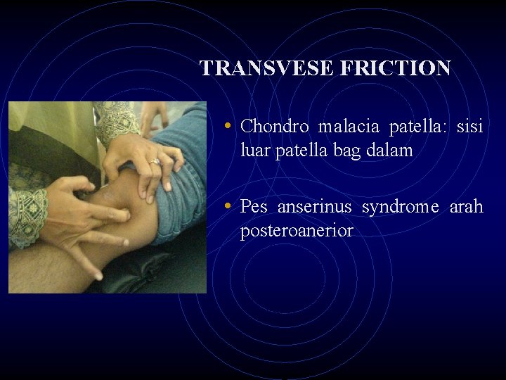 TRANSVESE FRICTION • Chondro malacia patella: sisi luar patella bag dalam • Pes anserinus