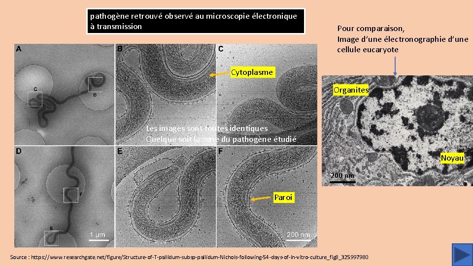 pathogène retrouvé observé au microscopie électronique à transmission Pour comparaison, Image d’une électronographie d’une