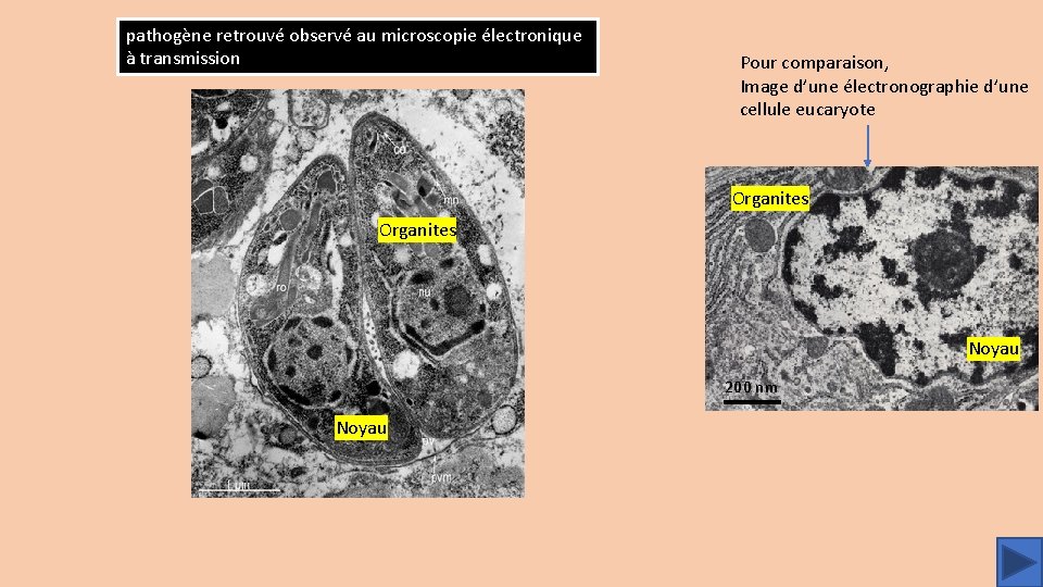 pathogène retrouvé observé au microscopie électronique à transmission Pour comparaison, Image d’une électronographie d’une