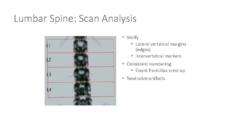 Lumbar Spine: Scan Analysis • Verify • Lateral vertebral margins (edges) • Intervertebral markers