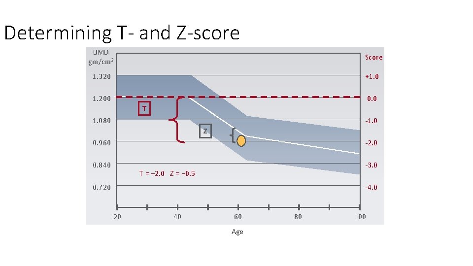 Determining T- and Z-score BMD gm/cm 2 Score 1. 320 +1. 0 1. 200