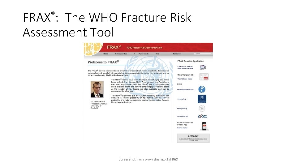 FRAX®: The WHO Fracture Risk Assessment Tool Screenshot from www. shef. ac. uk/FRAX 