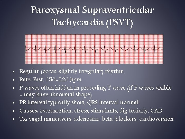 Paroxysmal Supraventricular Tachycardia (PSVT) • Regular (occas. slightly irregular) rhythm • Rate: Fast, 150