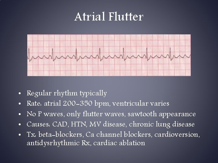 Atrial Flutter • • • Regular rhythm typically Rate: atrial 200 -350 bpm, ventricular Atrial Flutter • • • Regular rhythm typically Rate: atrial 200 -350 bpm, ventricular
