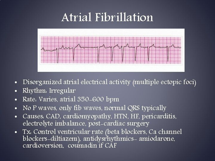 Atrial Fibrillation Disorganized atrial electrical activity (multiple ectopic foci) Rhythm: Irregular Rate: Varies, atrial