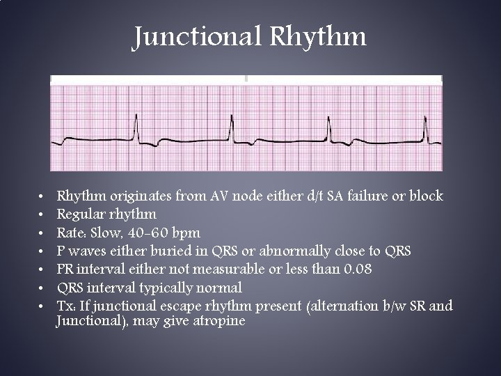 Junctional Rhythm • • Rhythm originates from AV node either d/t SA failure or