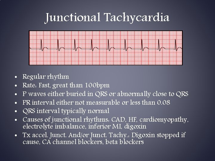 Junctional Tachycardia Regular rhythm Rate: Fast, great than 100 bpm P waves either buried