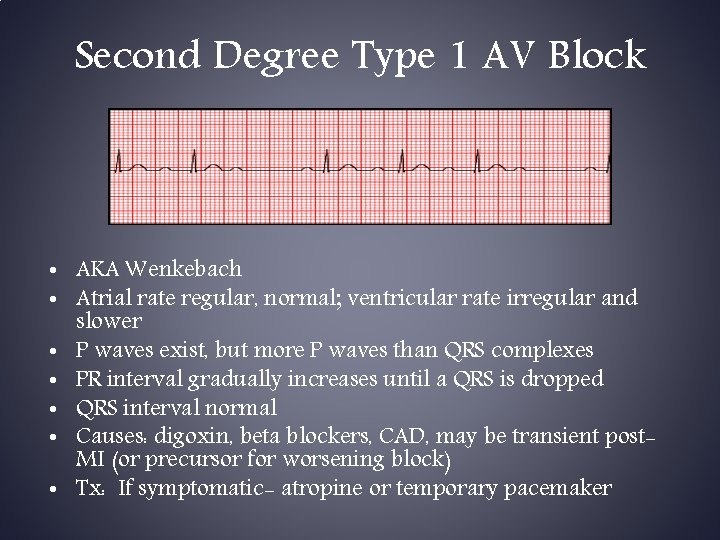 Second Degree Type 1 AV Block • AKA Wenkebach • Atrial rate regular, normal;