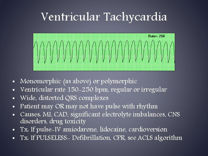 Ventricular Tachycardia Monomorphic (as above) or polymorphic Ventricular rate 150 -250 bpm, regular or