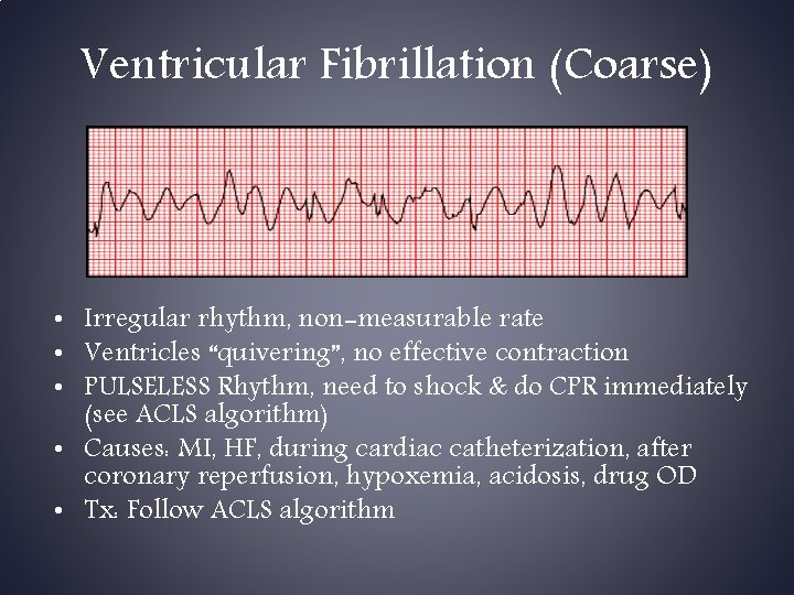 Ventricular Fibrillation (Coarse) • Irregular rhythm, non-measurable rate • Ventricles “quivering”, no effective contraction