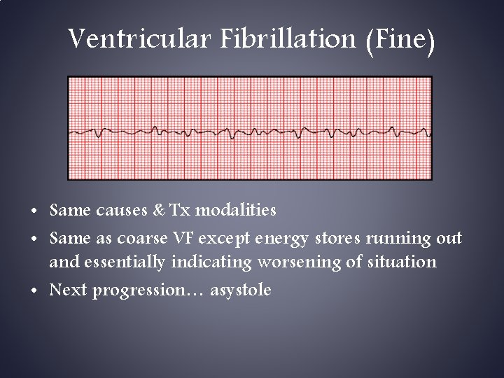 Ventricular Fibrillation (Fine) • Same causes & Tx modalities • Same as coarse VF Ventricular Fibrillation (Fine) • Same causes & Tx modalities • Same as coarse VF