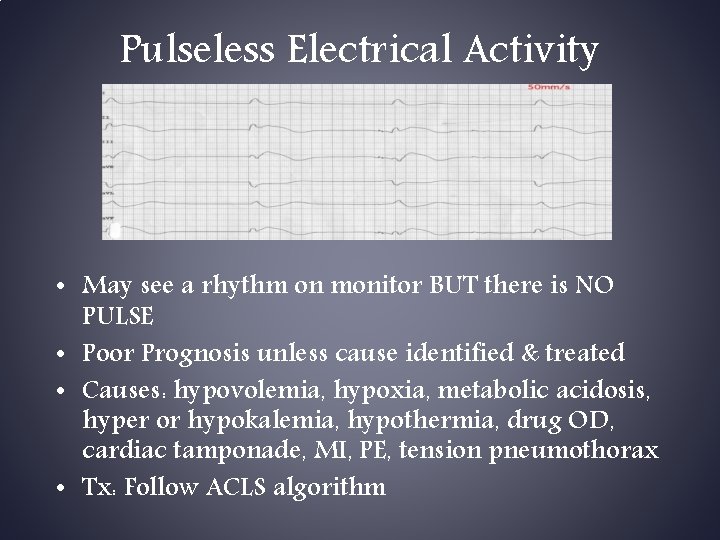 Pulseless Electrical Activity • May see a rhythm on monitor BUT there is NO Pulseless Electrical Activity • May see a rhythm on monitor BUT there is NO