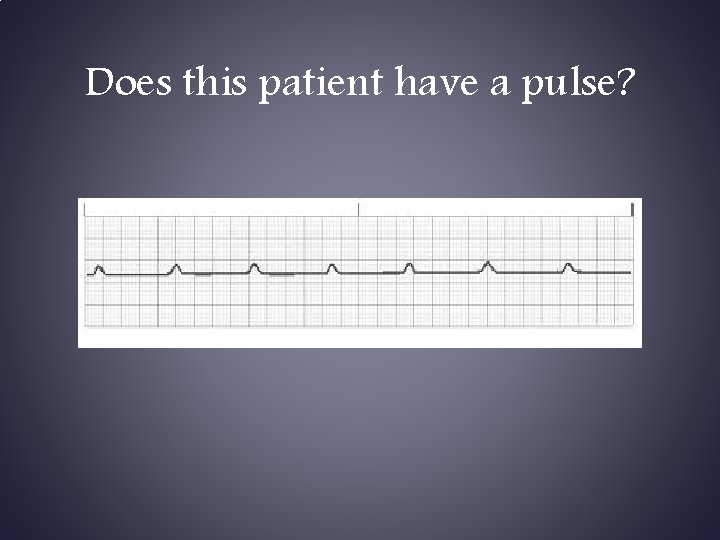 Does this patient have a pulse? 