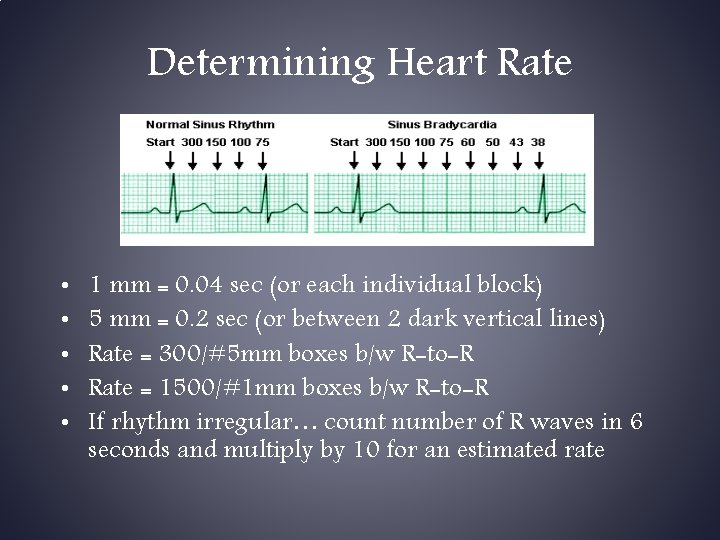 Determining Heart Rate • • • 1 mm = 0. 04 sec (or each Determining Heart Rate • • • 1 mm = 0. 04 sec (or each
