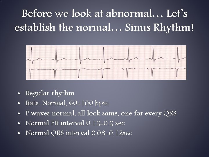 Before we look at abnormal… Let’s establish the normal… Sinus Rhythm! • • •