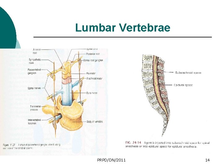 Lumbar Vertebrae PRPD/DN/2011 14 