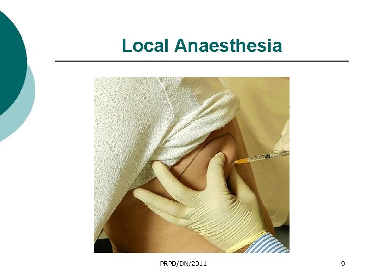 Local Anaesthesia PRPD/DN/2011 9 