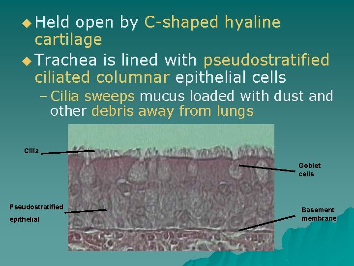 u Held open by C-shaped hyaline cartilage u Trachea is lined with pseudostratified ciliated
