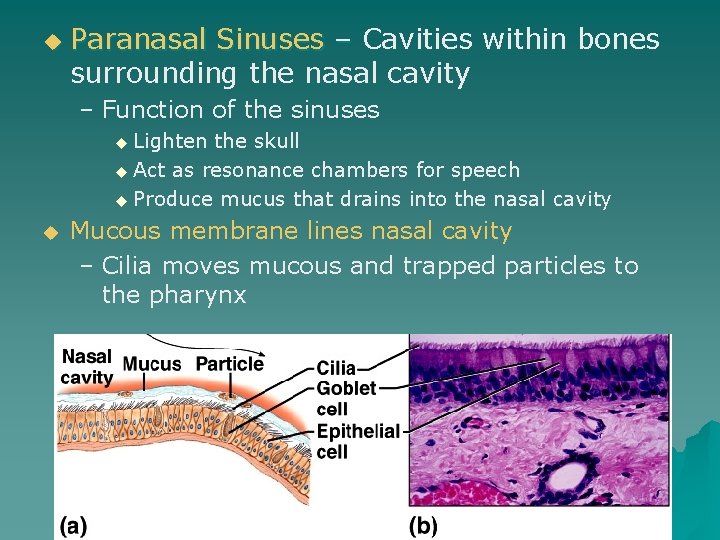 u Paranasal Sinuses – Cavities within bones surrounding the nasal cavity – Function of