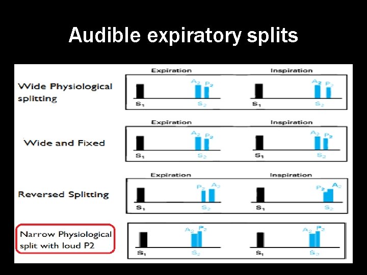 Audible expiratory splits 