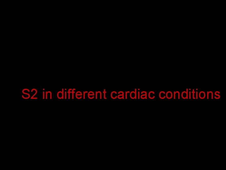S 2 in different cardiac conditions 
