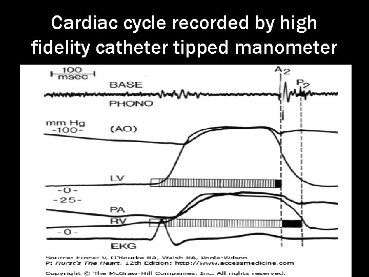 Cardiac cycle recorded by high fidelity catheter tipped manometer 