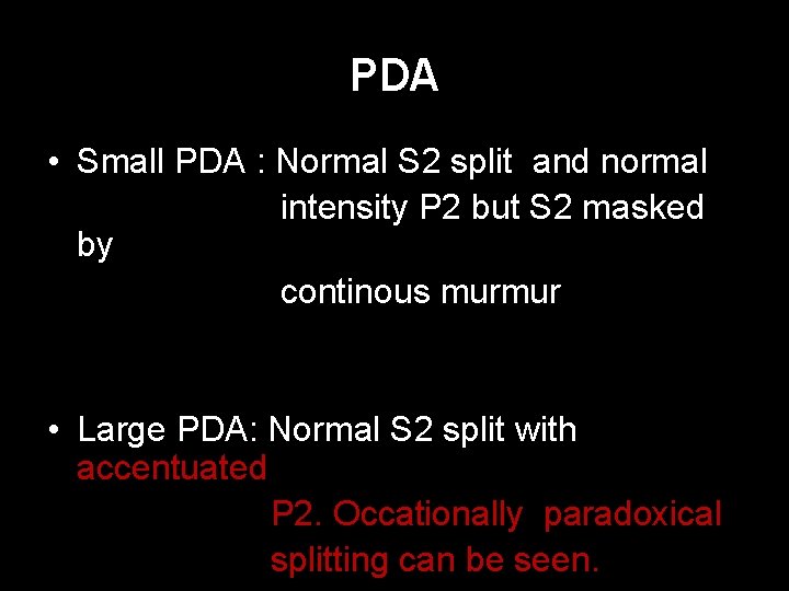 PDA • Small PDA : Normal S 2 split and normal intensity P 2