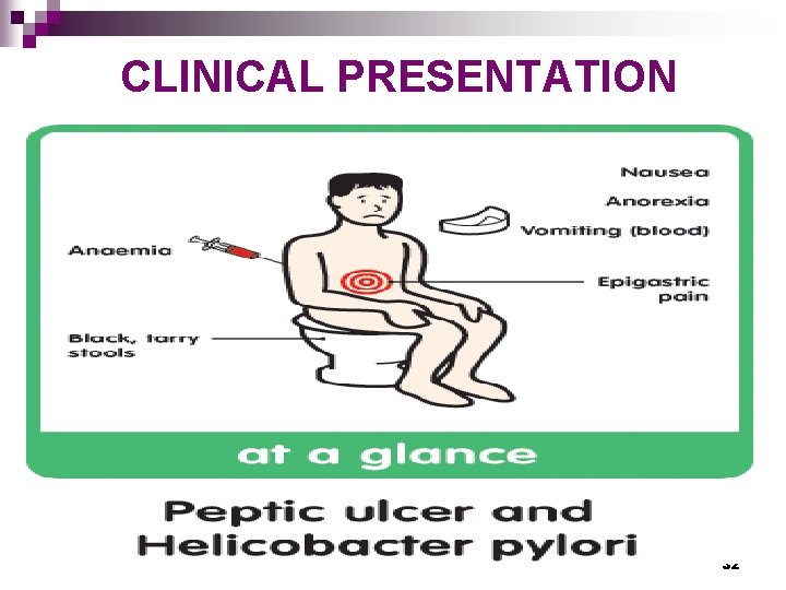 CLINICAL PRESENTATION 32 