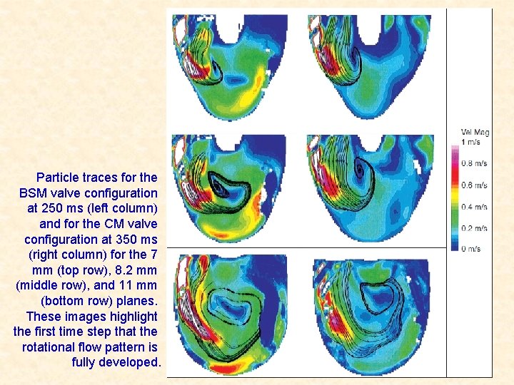 Particle traces for the BSM valve configuration at 250 ms (left column) and for