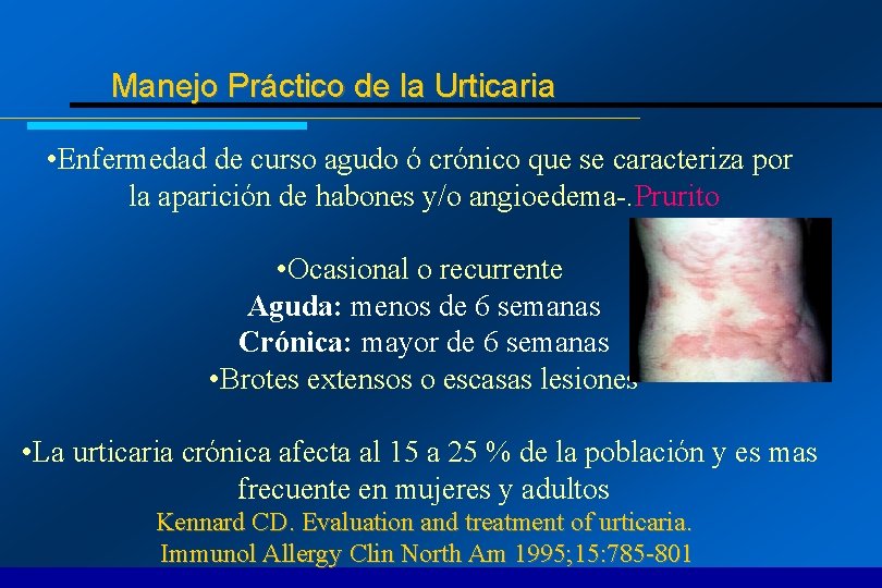 Manejo Práctico de la Urticaria • Enfermedad de curso agudo ó crónico que se