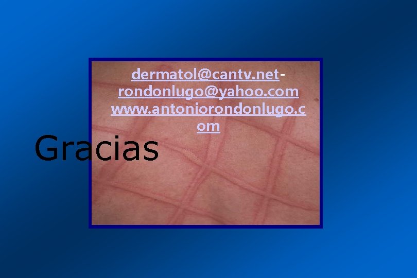 dermatol@cantv. netrondonlugo@yahoo. com www. antoniorondonlugo. c om Gracias 