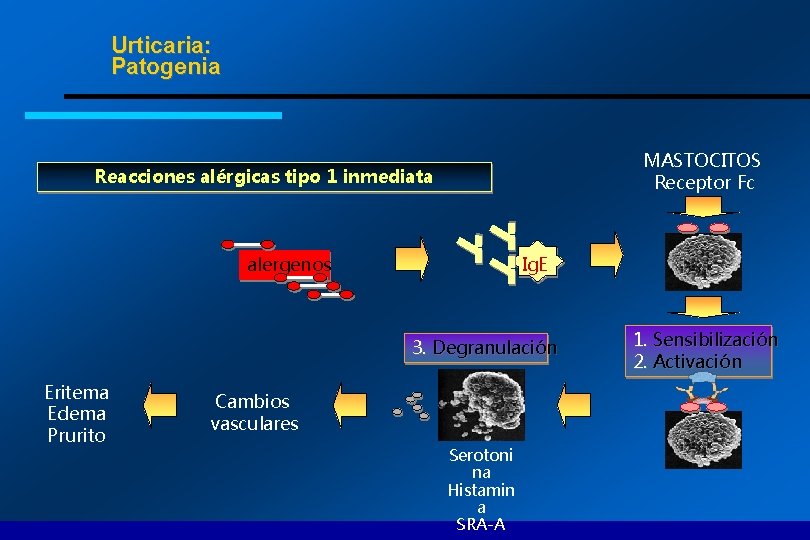 Urticaria: Patogenia MASTOCITOS Receptor Fc Reacciones alérgicas tipo 1 inmediata Ig. E alergenos 3.