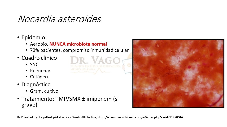 Nocardia asteroides • Epidemio: • Aerobio, NUNCA microbiota normal • 70% pacientes, compromiso inmunidad