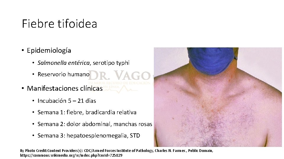 Fiebre tifoidea • Epidemiología • Salmonella entérica, serotipo typhi • Reservorio humano • Manifestaciones