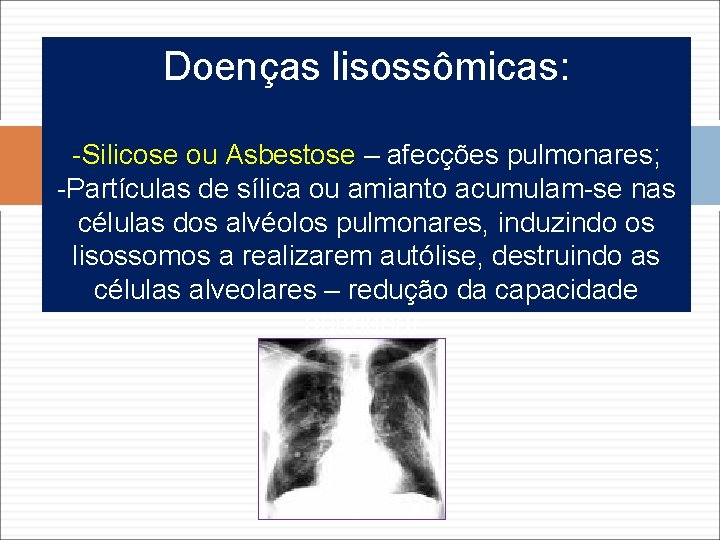 Doenças lisossômicas: -Silicose ou Asbestose – afecções pulmonares; -Partículas de sílica ou amianto acumulam-se Doenças lisossômicas: -Silicose ou Asbestose – afecções pulmonares; -Partículas de sílica ou amianto acumulam-se