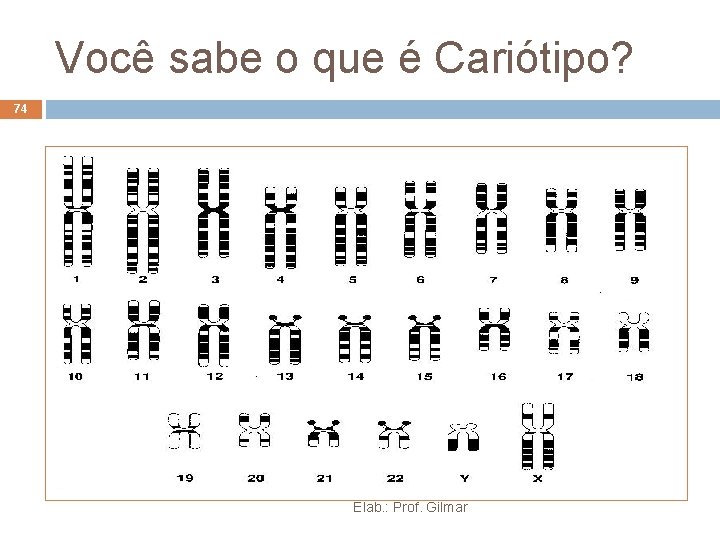 Você sabe o que é Cariótipo? 74 Elab. : Prof. Gilmar Você sabe o que é Cariótipo? 74 Elab. : Prof. Gilmar