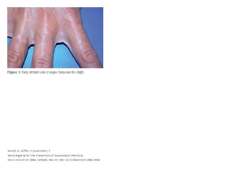 Kampf, G; Löffler, H; Gastmeier, P Hand Hygiene for the Prevention of Nosocomial Infections
